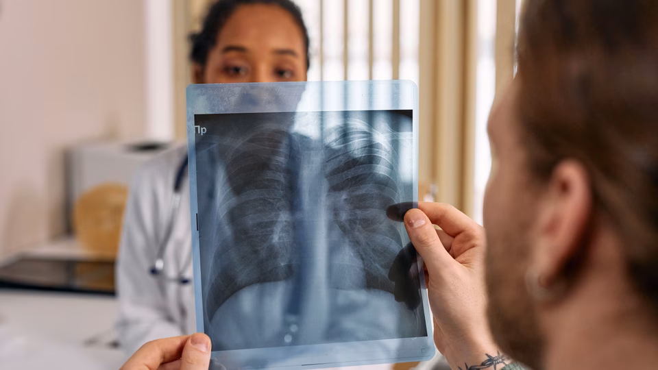 Pulmonologist Dr Harish Verma shares 5 lung cancer symptoms people mistake for lifestyle issues