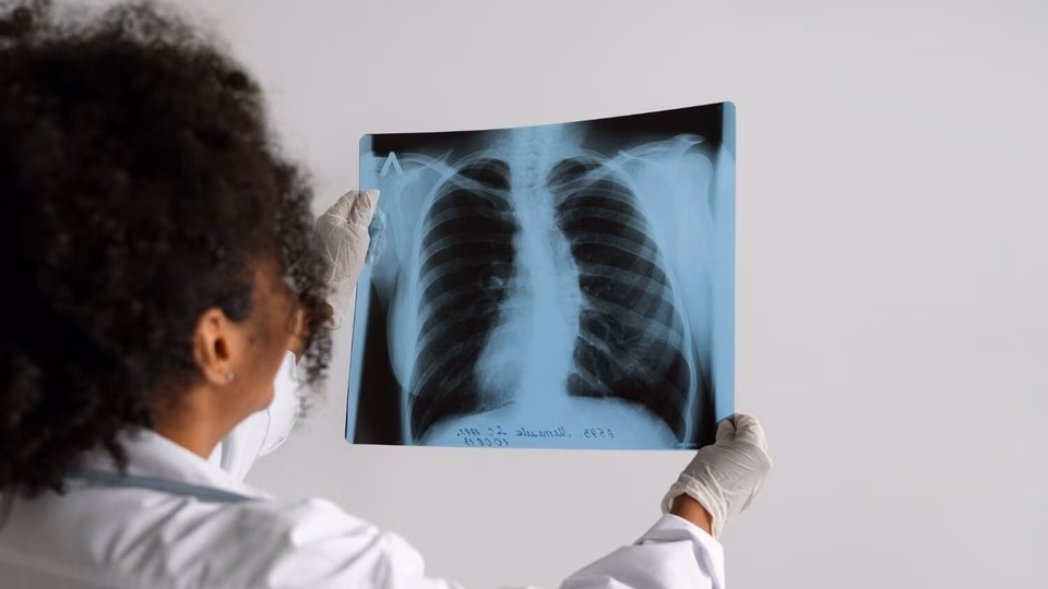 Your Lungs May Be Ageing Faster Than You: Pulmonologist Shares 7 Causes And Signs You Should Not Ignore 38 Your lungs may be ageing faster than you: Pulmonologist shares 7 causes and signs you should not ignore